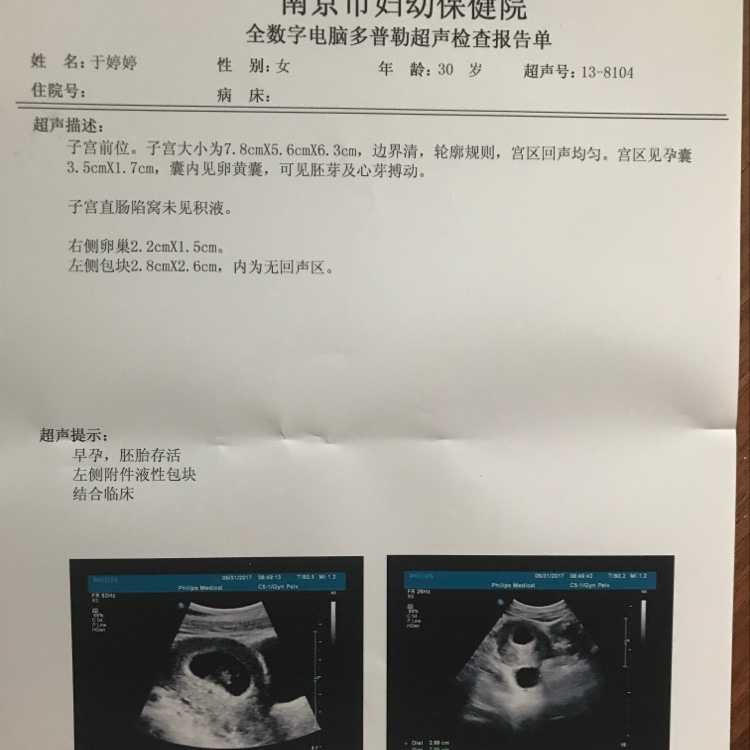 上海助孕医生提醒，上海供卵助孕：供卵上海