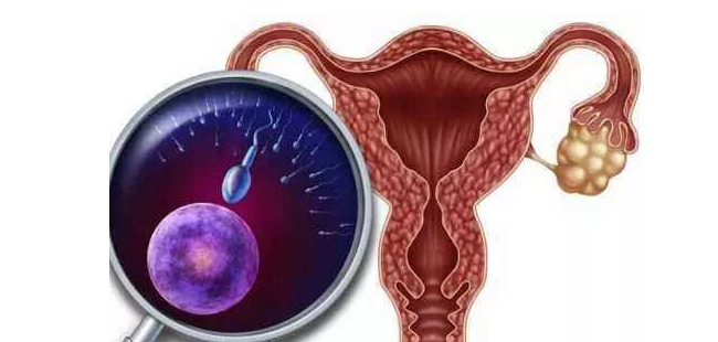 探索子宫肌瘤之谜：揭示其成因与症状，女性健