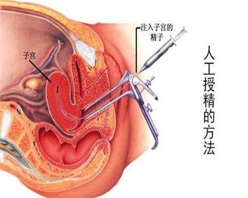 上海代孕妈妈服务：代孕初期出血怎么办_金凤丸