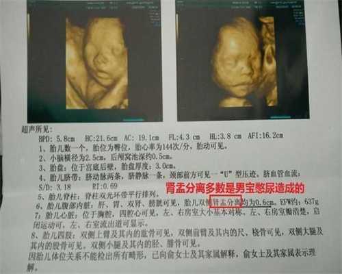 上海添宝助孕：排卵后同房多久可以测出代孕_美