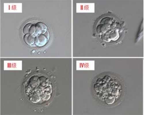 上海诺贝尔代孕：我B超显示双测卵巢多囊样改变