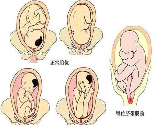 上海美满助孕：助孕生孩子那些事之“是的，助