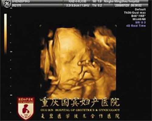 警惕：代孕降雨天出行的安全指南 中国达人秀琳