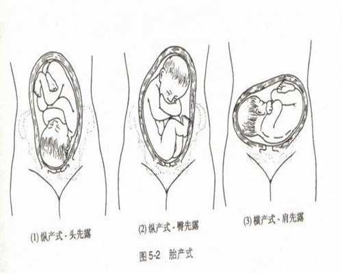 孕两个月的孕囊可能只有这般大小，可通过B超检