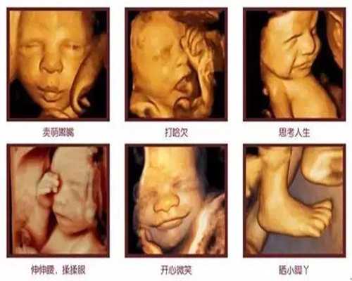 武汉同济医院男性不孕不育专科：代孕到生孩子