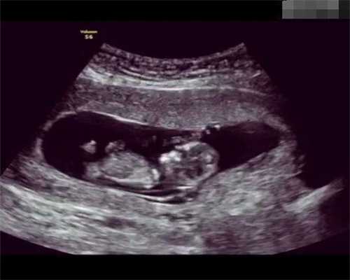 武汉同济医院男性不孕不育专科：代孕到生孩子