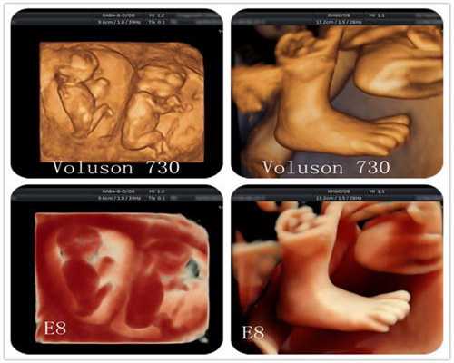 胎儿1-10月发育过程动图更加真实的感受胎儿的成