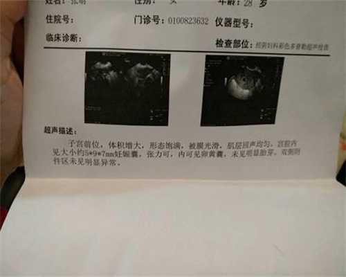 上海找代孕的论坛~上海借卵试管国内医院可以做