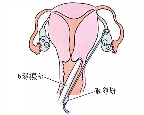 上海代孕公司比较～上海地下供卵试管可靠吗～