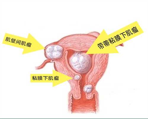 西安卵巢早衰试管代代怀孕_西安正规代代怀孕企