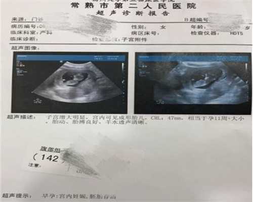 上海专业找代怀孕价格-代怀孕宝宝换尿布