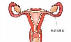 广州助孕流程，试管供卵至上广州三甲助孕,助孕的服务机构